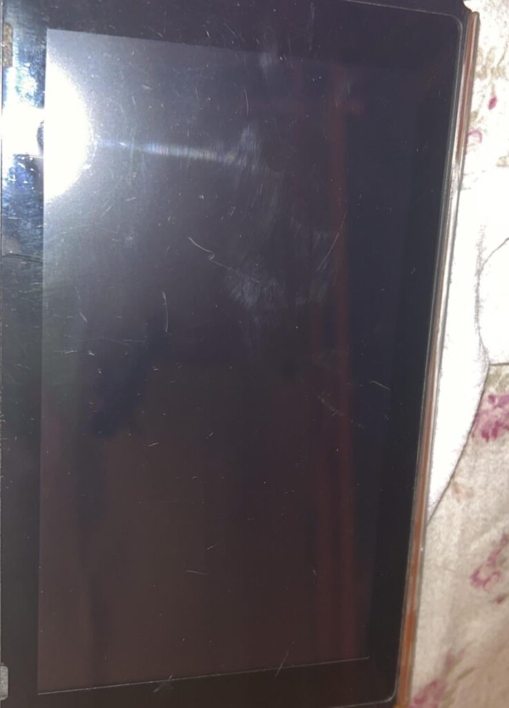 is there anyway i get rid of these scratches??