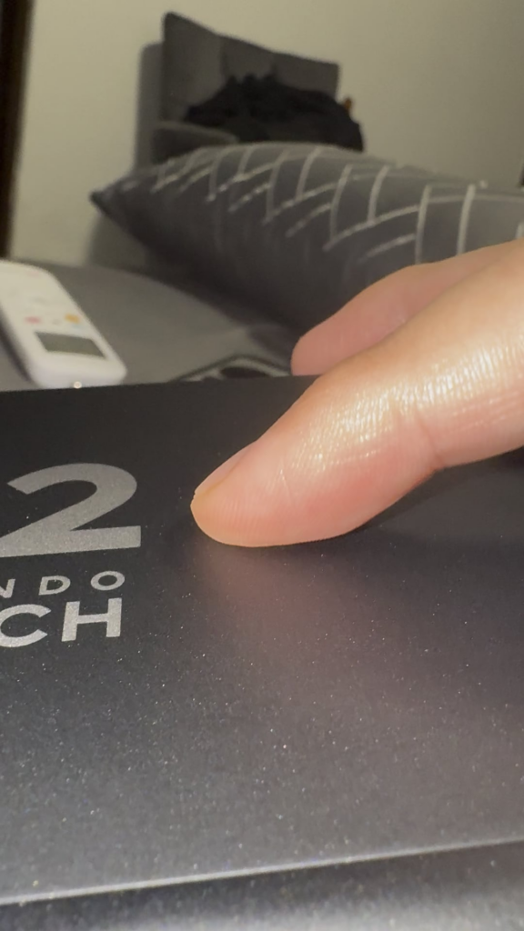 Could the Switch 2's swollen battery reports actually be just a design issue?