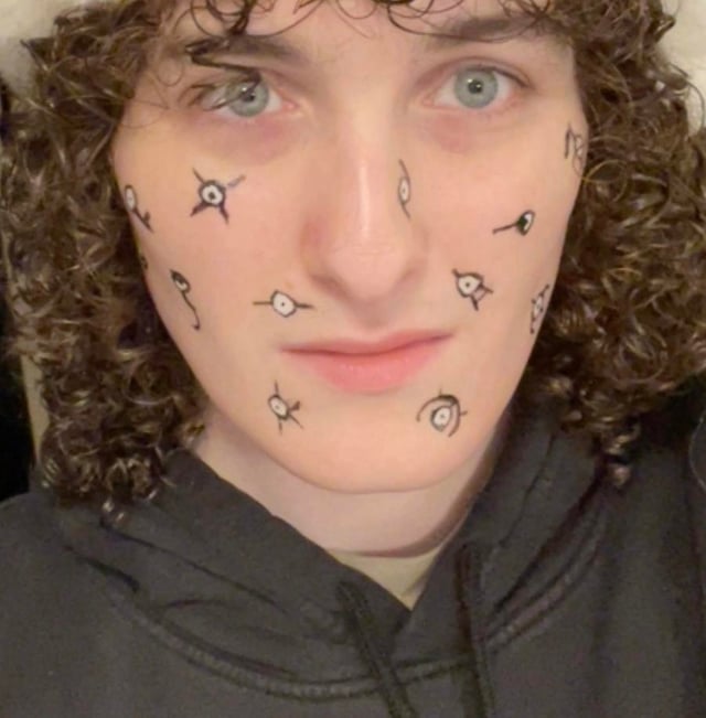 A case of pox from an unknown origin (worn to local Pokemon event)